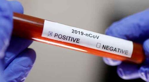 Eskişehirspor'da koronavirüs vaka sayısı artıyor!