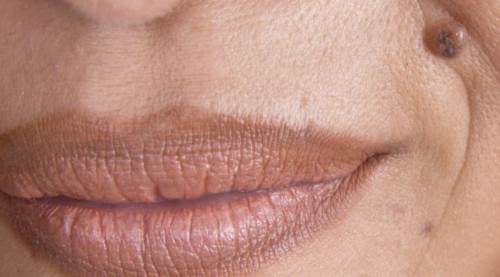 Et Beni Temizleme Nasıl Yapılır? Zararı Var Mıdır?