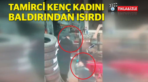 Eyüp'te tamirci kadını baldırından ısırdı