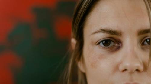 Göz kanlanması ne zaman tehlikeli? Basit bir kızarıklık sandığınız belirti ciddi hastalığın habercisi olabilir