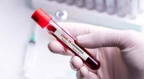 Güncel koronavirüs tablosuna göre vaka sayısı...