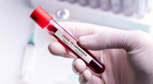 Günlük koronavirüs vaka sayısında büyük artış!