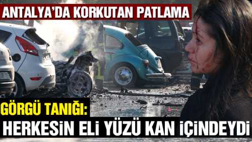 Herkesin eli yüzü kan içindeydi