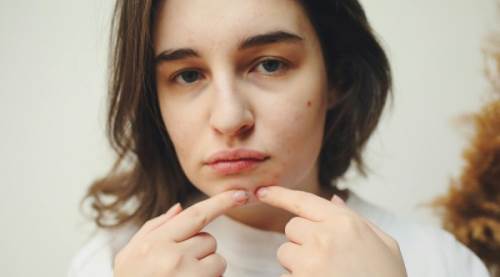 Hidrokolloid Akne Bandı Nedir? İşe Yarıyor Mu?