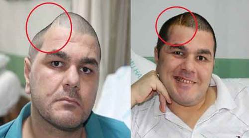 İki fotoğraf arasında inanılmaz fark