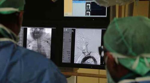 İnmeye ameliyatsız çözüm