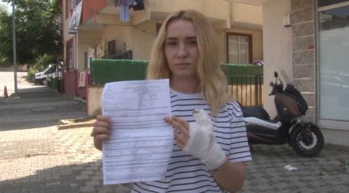 İşyerinde akıl almaz olay: Parmağını ısırdı!