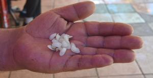 İşte böbrek taşını düşüren taş