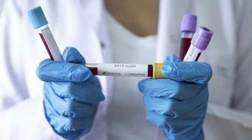 İyileşen hasta sayısı düştü, vaka sayısı yükseldi!