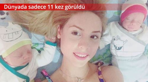 İzmirli anne hamileyken hamile kaldı!