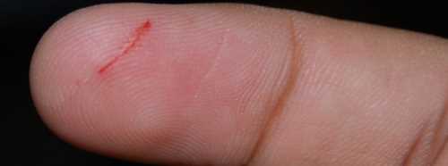 KAĞIT KESİĞİ NEDEN ÇOK ACITIR?