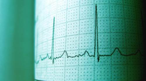 Kalp Krizi Teşhisinde EKG Yeterli mi? Tam Resmin Perde Arkası