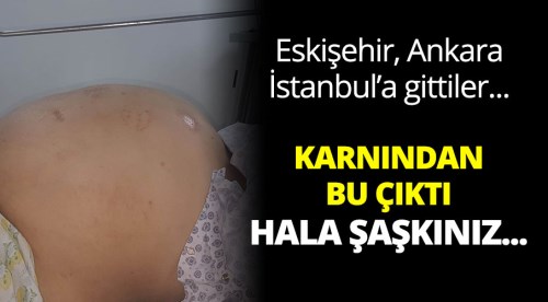 Karnından 25 kg kitle çıktı!