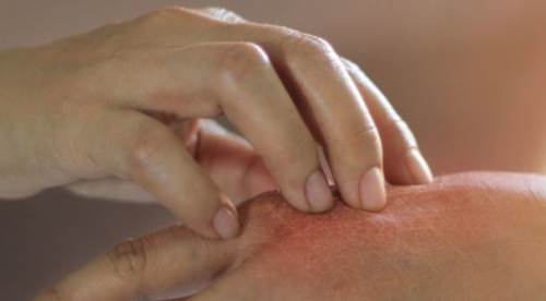 Kışın Kaşıntı ve Kızarıklık Artıyorsa Sebebi Evinizde Olabilir!