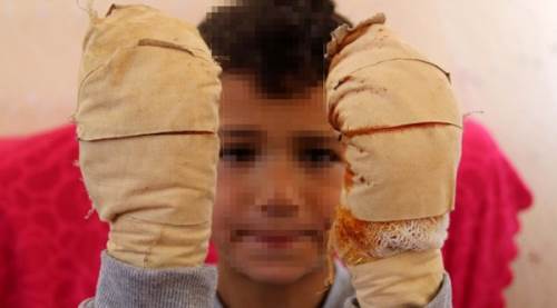 Komşu çocuğu, küçük Efe’ye dehşeti yaşattı	