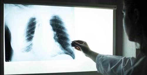 Kontrast madde nedir? Kontrast madde nasıl çalışır?