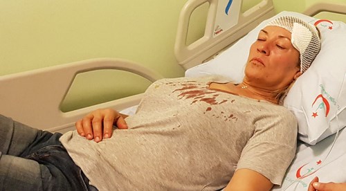 Köpek gezdirirken taşla saldırdılar