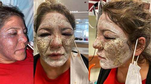 Korkunç! Güzellik salonunda bu hale geldi!