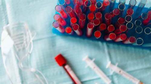 Korkutan "mutasyonlu virüs" açıklaması!