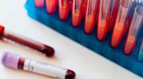 Koronavirüs rakamlarında sevindiren gelişme