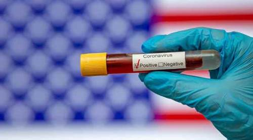 Koronavirüs tablosunda bugünkü verilere göre...