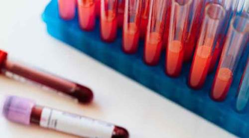 Koronavirüs tablosunda değişen yok...