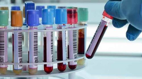 Koronavirüs tablosunda göre 22 Haziran 2020 verileri açıklandı