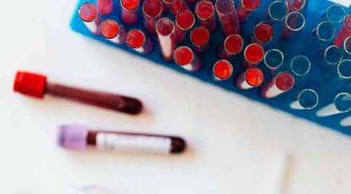 Koronavirüs tablosunda son durum: Vaka sayısında artış...