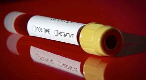 Koronavirüs tablosunda uzun bir aradan sonra ilk kez...