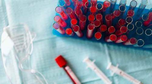 Koronavirüs vaka sayıları 4. gününde de 1000'in altında...