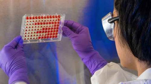 Koronavirüs vaka sayıları nihayet...