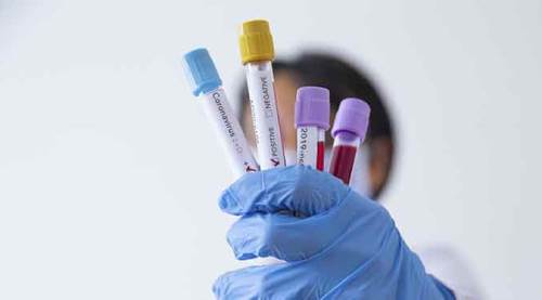 Koronavirüs vaka sayıları yeniden 70 bine dayandı