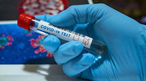 Koronavirüs vaka sayılarında hızlı düşüş sürüyor