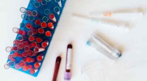 Koronavirüs vaka sayılarında iki günde büyük sıçrama