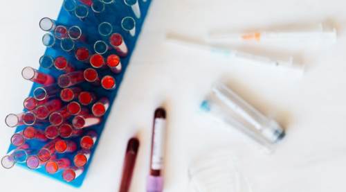 Koronavirüs vaka sayılarında son durum: 17 Ocak 2022