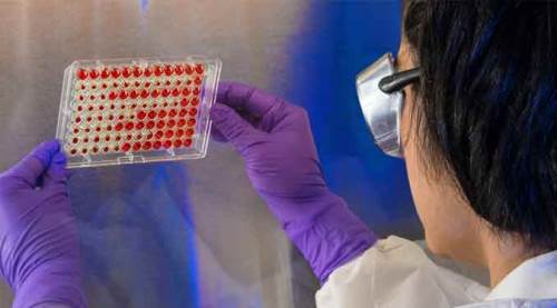 Koronavirüs vaka sayısı 14 bini de devirdi!