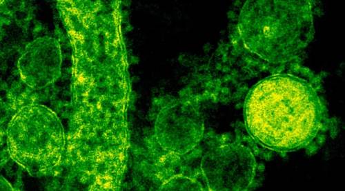 Koronavirüs vaka sayısı uçuşa geçti!