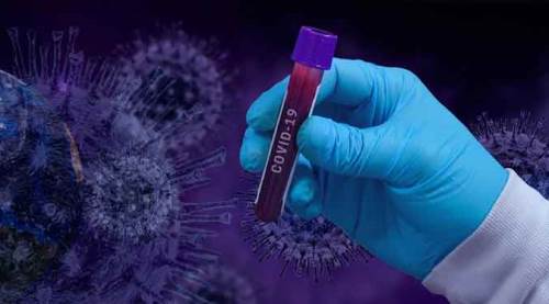 Koronavirüste günün tablosu: 50 bin vaka, 237 vefat