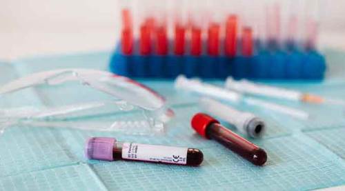 Koronavirüste tablo korkutuyor: Vaka sayısı 42 bini de aştı!