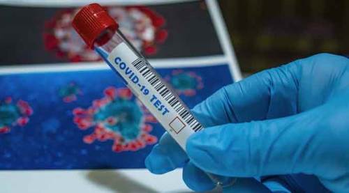 Koronavirüste vaka sayısı yine 61 bin...