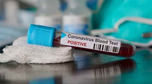 Koronavirüsten 28 kişi daha hayatını kaybetti!