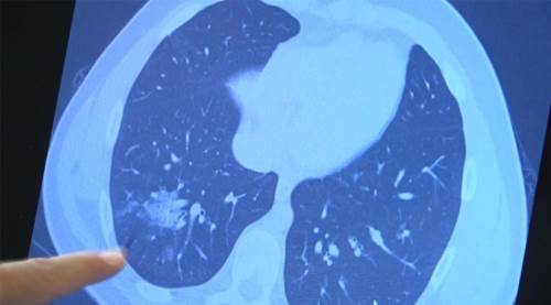 Koronavirüsün çocuklardaki tehlikesi büyüyor!