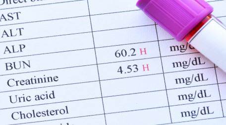 Kreatin Kullanımı: Dozaj, Faydaları, Kimler Kullanmalı? Zararları Nelerdir? 