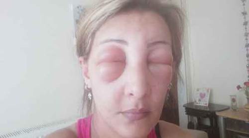 Kuaföre gitti, ölümden döndü!