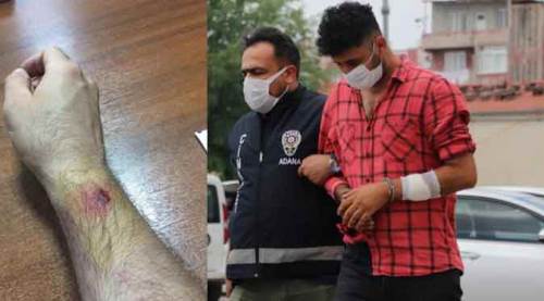 Kumarda basıldı, komiserin elini ısırdı!