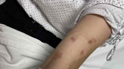 Lavabo açıcı bomba gibi patladı!