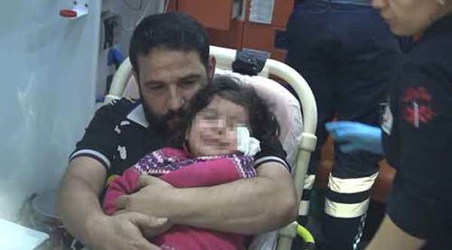 Makyaj malzemesi sandığı yapıştırıcıyla gözlerini yapıştırdı