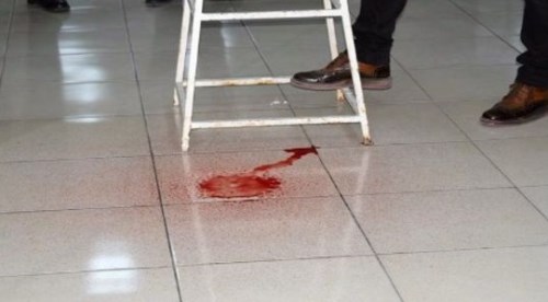 Malatya'yı karıştıran görüntü...