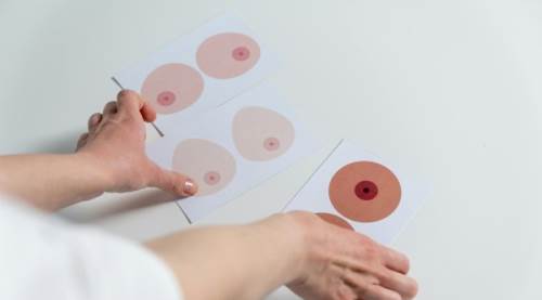 Mamografi Çektirmenin Zararları: Bilinçli Bir Yaklaşım