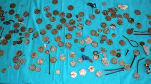 Midesinden çıkanlar doktorları bile hayrete düşürdü